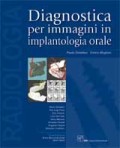 Diagnostica per Immagini in Implantologia Orale