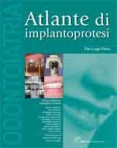 Atlante di Implantoprotesi